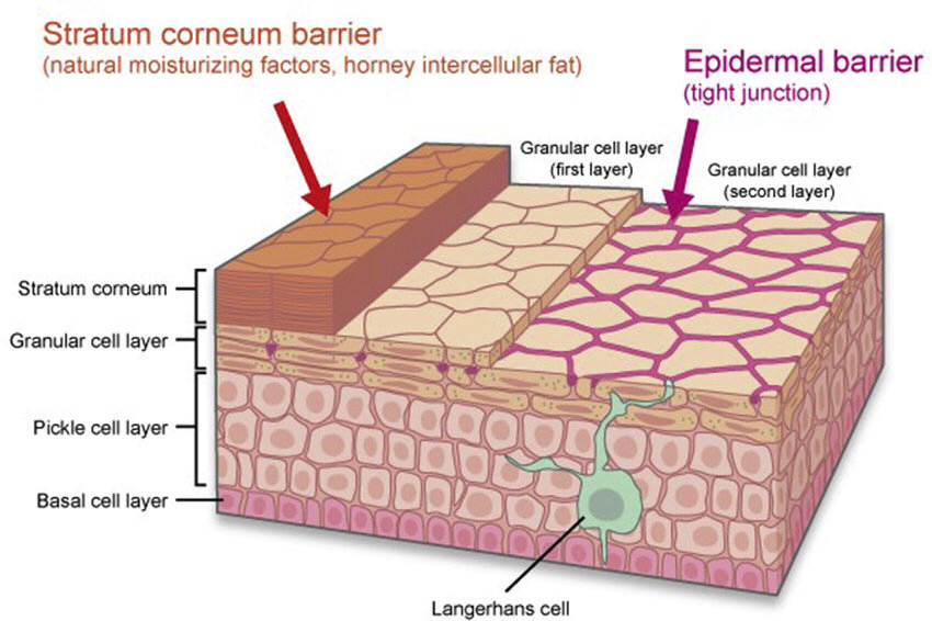 skin barrier diagram showing stratum corneum transepidermal water loss and barrier damage in oily skin