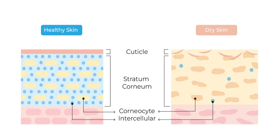 skin barrier diagram showing stratum corneum ceramides and transepidermal water loss in damaged skin