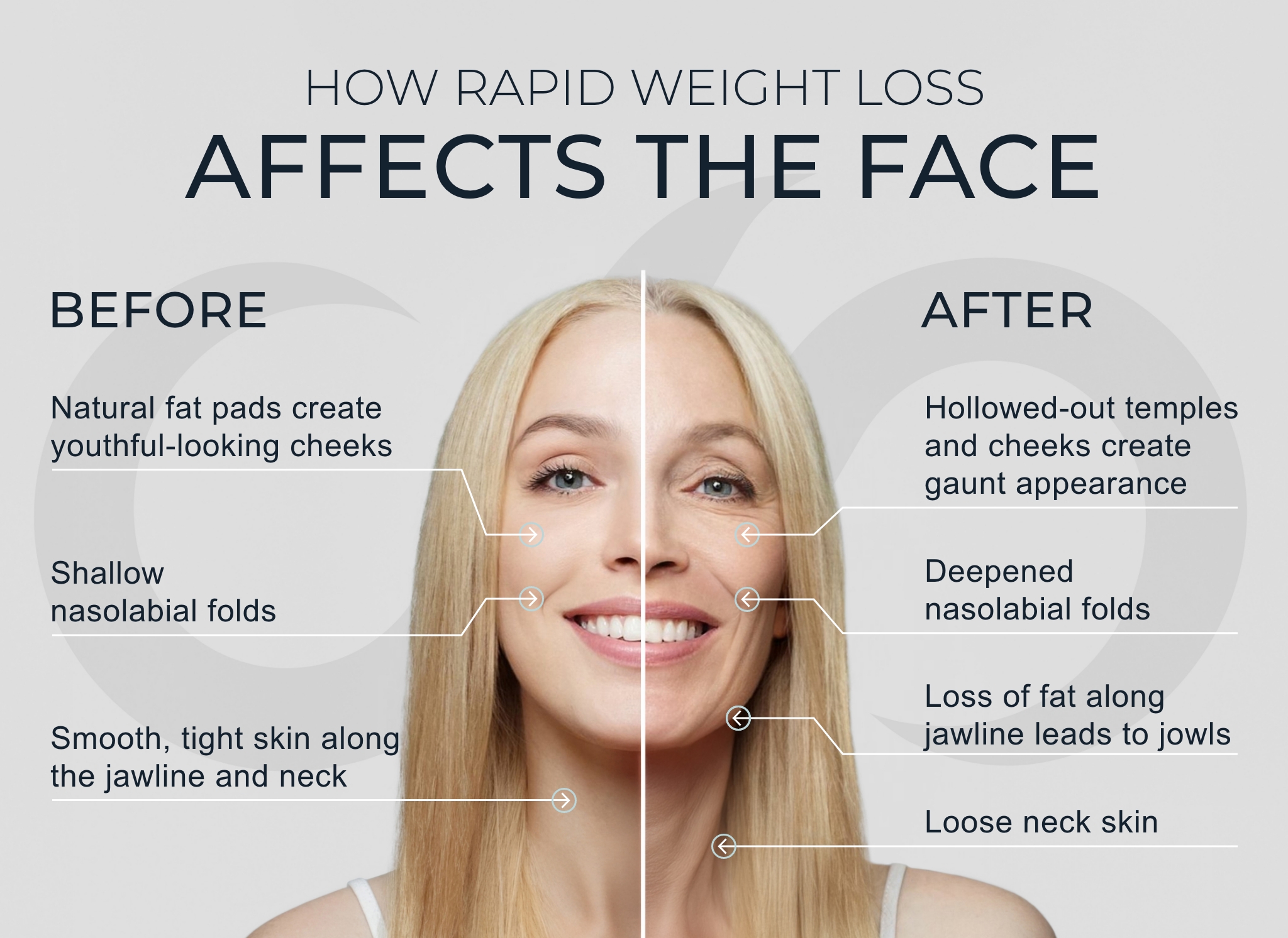 Ozempic Face Explained: What It Is, Why It Happens & How to Fix It — Skin guide by It Girlies