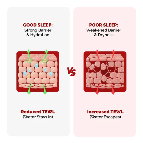 Diagram comparing healthy skin barrier with good sleep vs weakened skin barrier from poor sleep showing hydration loss and increased transepidermal water loss (TEWL).